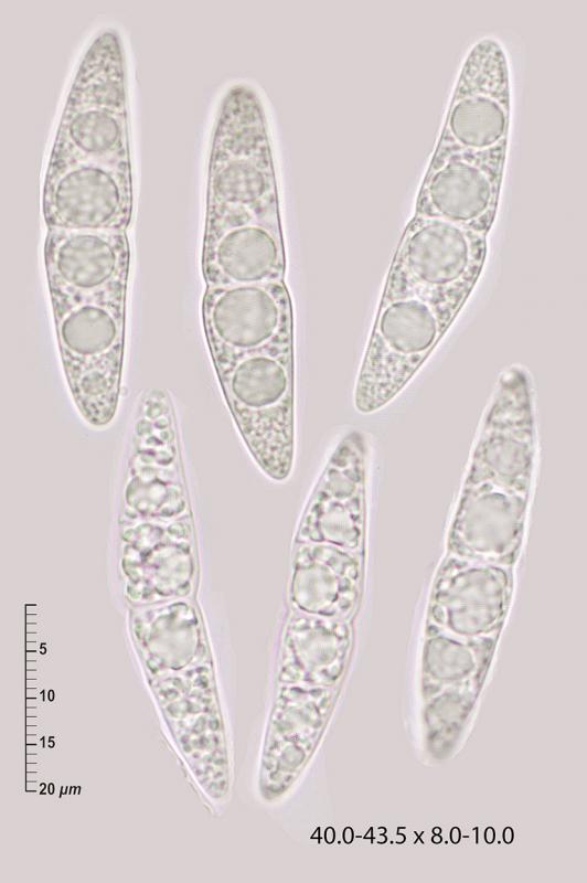 macrostoma