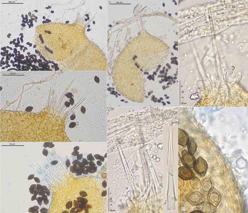 macrostoma