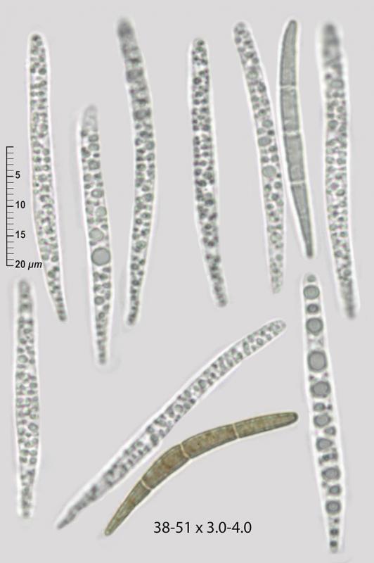 macrostoma