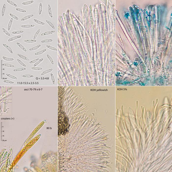 macrostoma