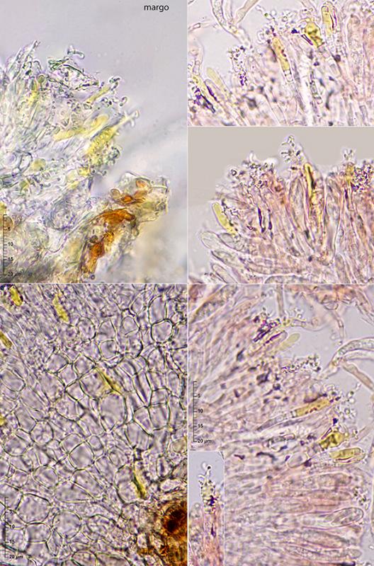 macrostoma