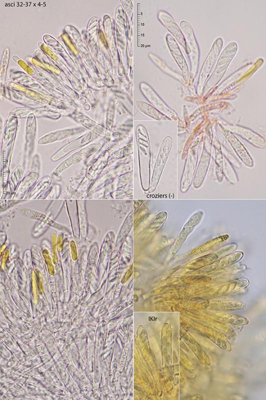 macrostoma