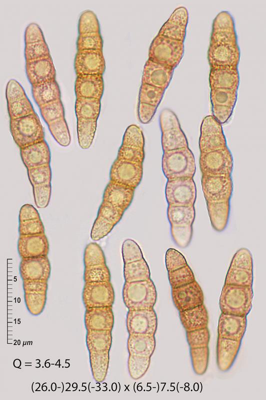 macrostoma