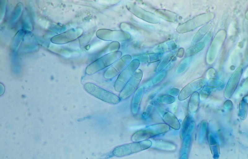 macrostoma