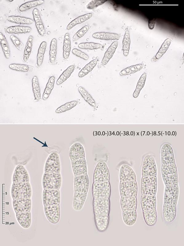 macrostoma