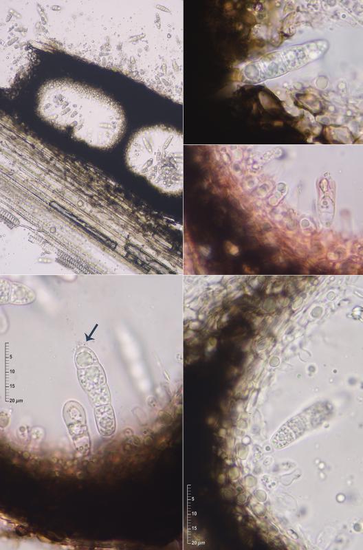 macrostoma