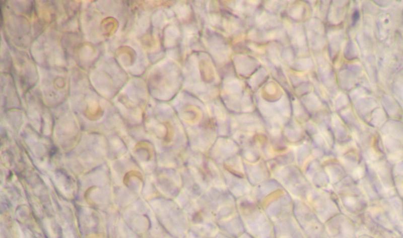 macrostoma