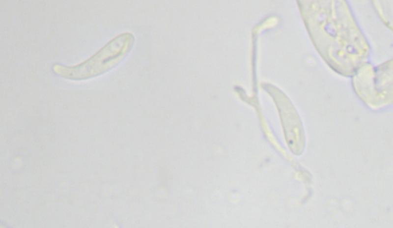 macrostoma