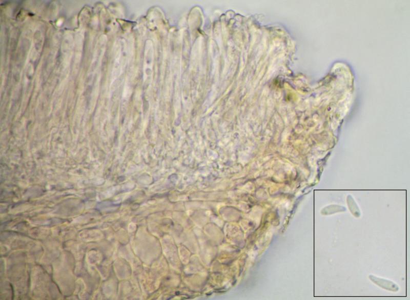 macrostoma