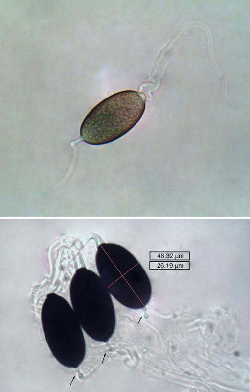 macrostoma