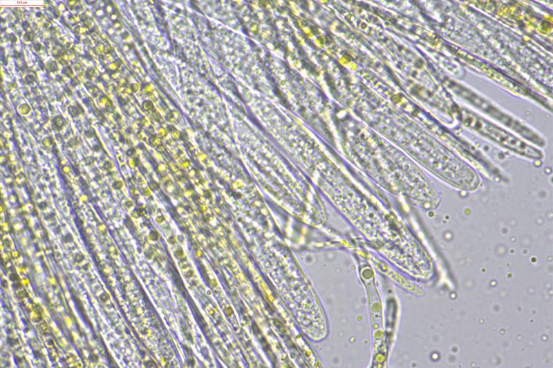 macrostoma