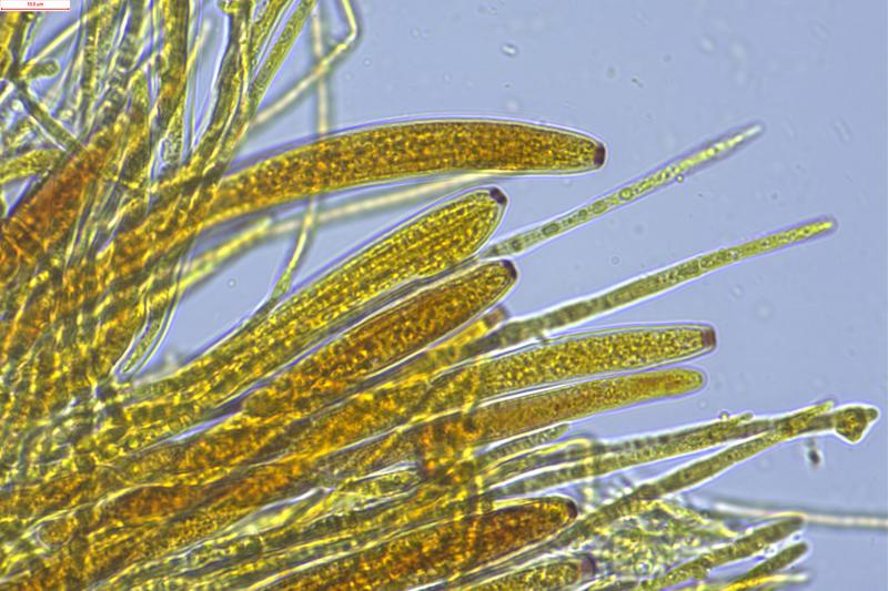 macrostoma