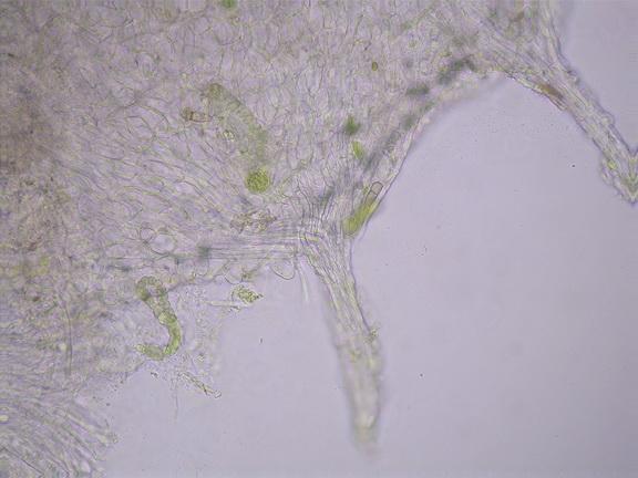 macrostoma