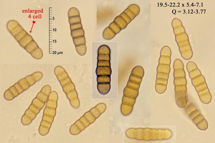 macrostoma
