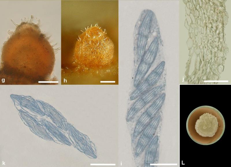 macrostoma
