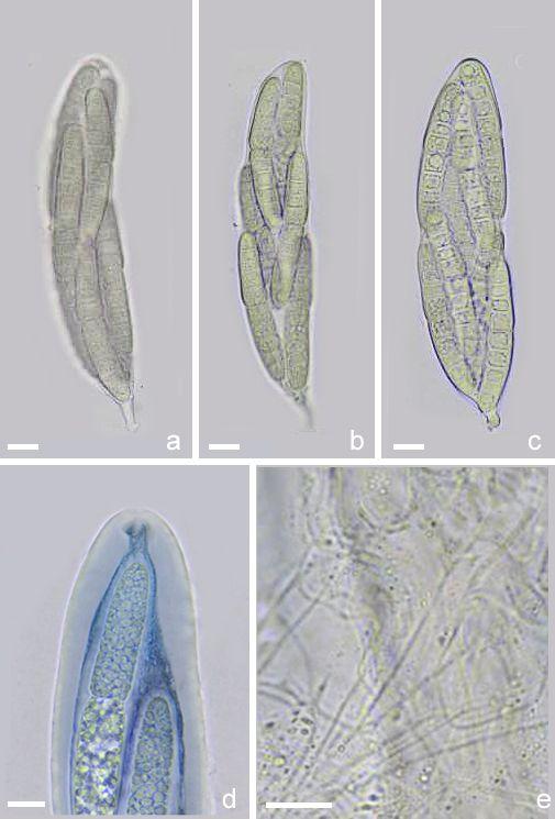 macrostoma