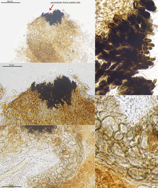 macrostoma