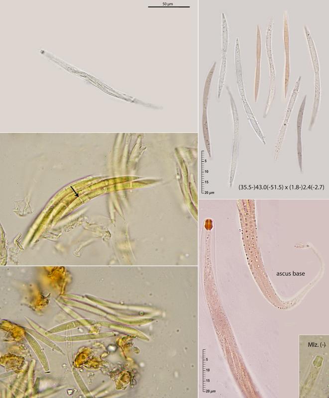macrostoma