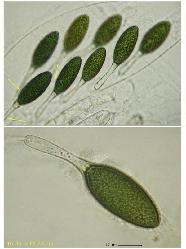 macrostoma