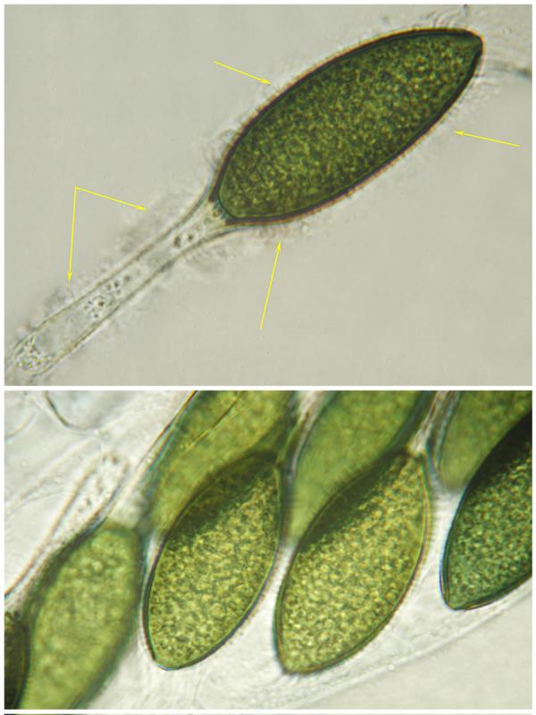 macrostoma