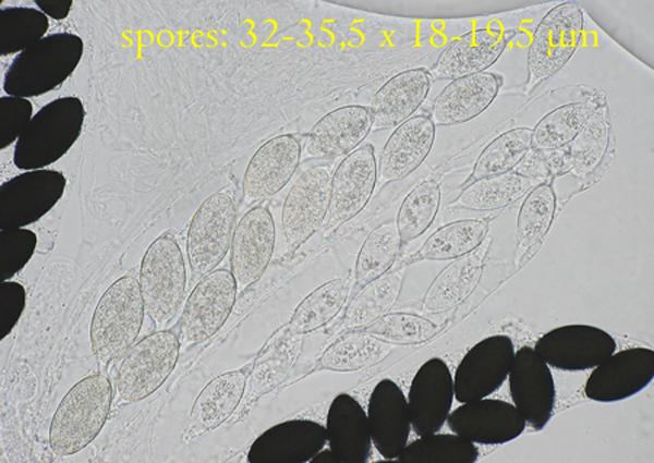 macrostoma