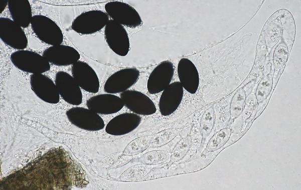 macrostoma