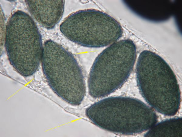 macrostoma