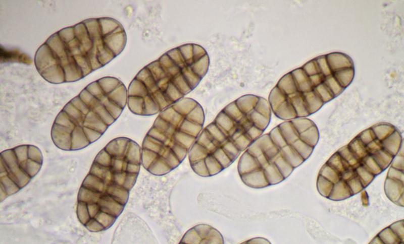 macrostoma