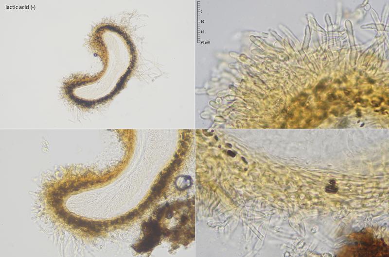 macrostoma