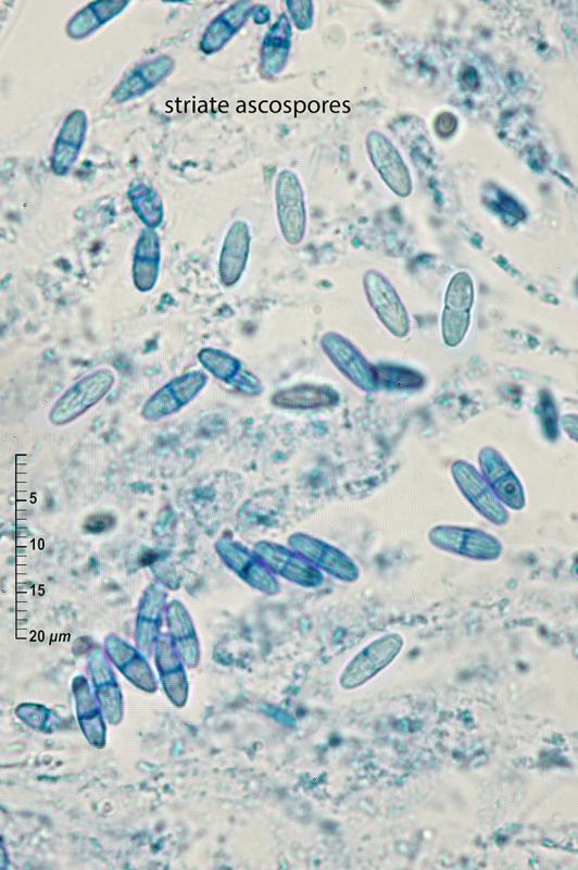 macrostoma