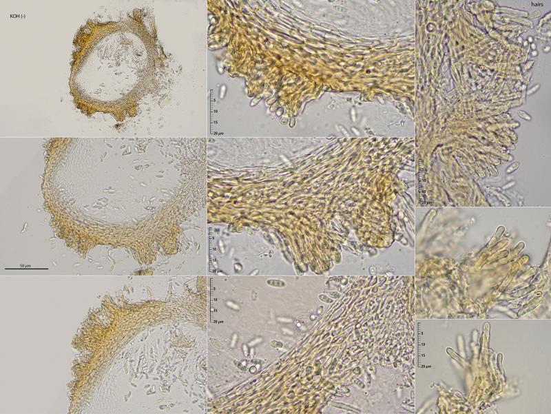 macrostoma