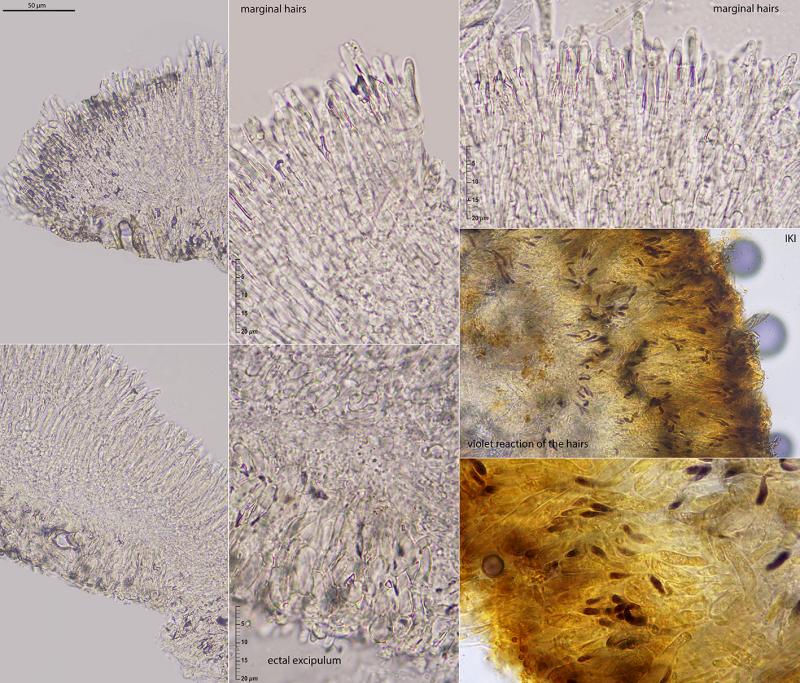 macrostoma