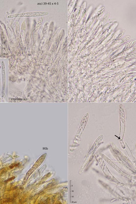 macrostoma