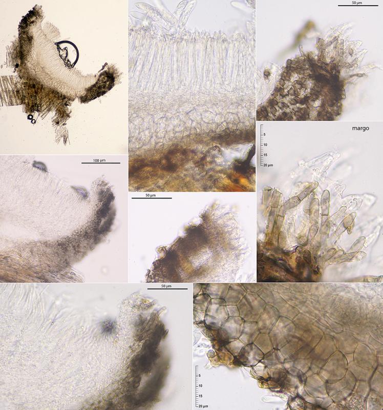 macrostoma