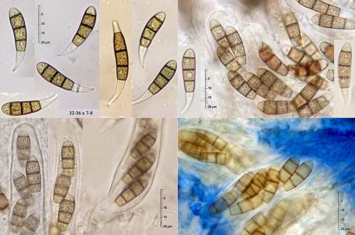 macrostoma