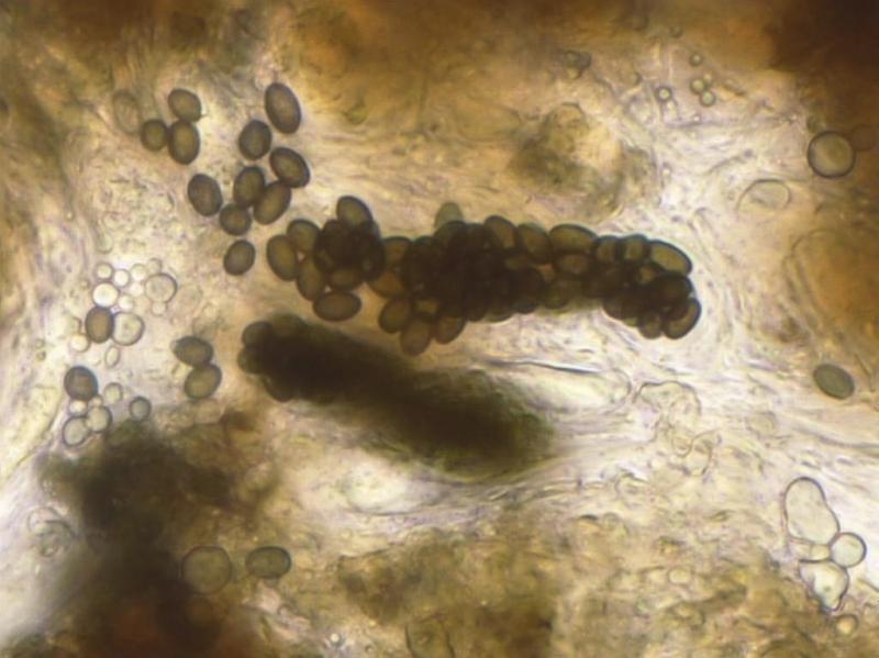 macrostoma