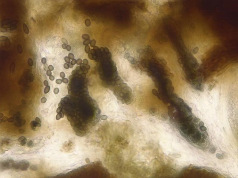macrostoma