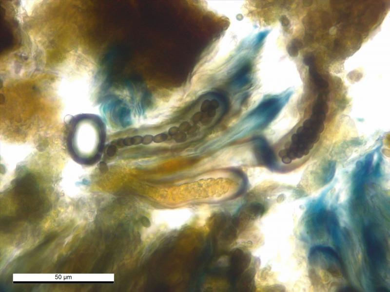 macrostoma