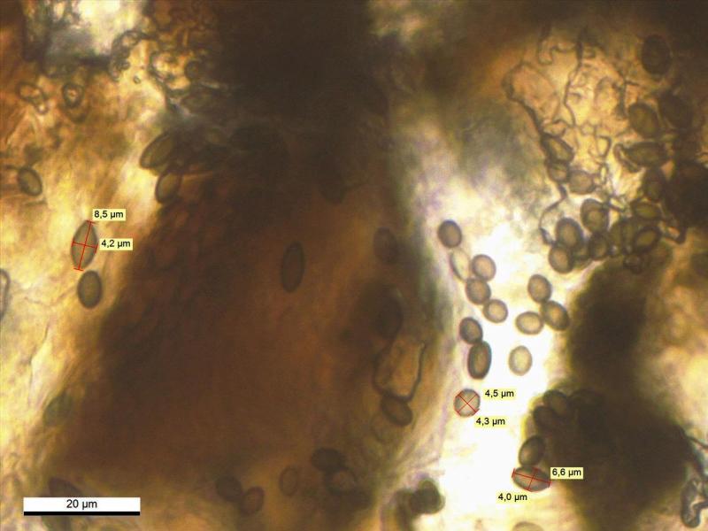 macrostoma