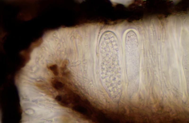 macrostoma