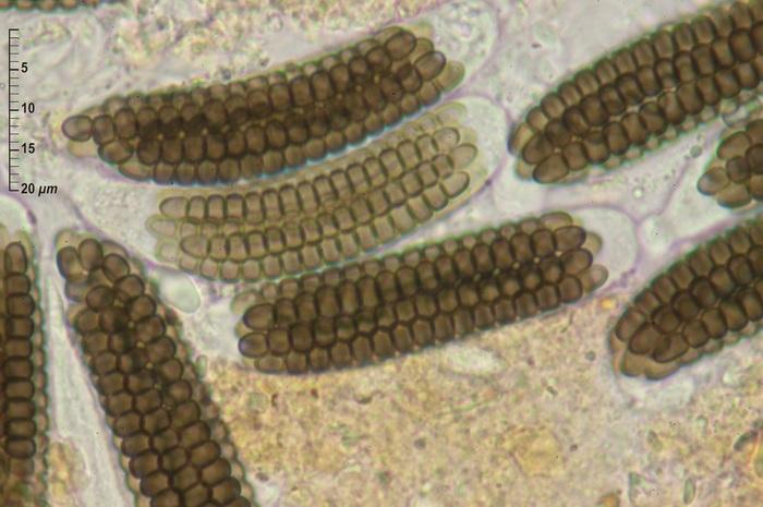 macrostoma