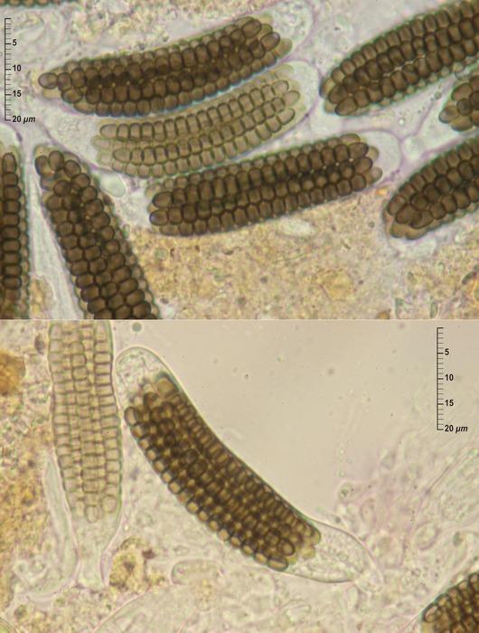 macrostoma