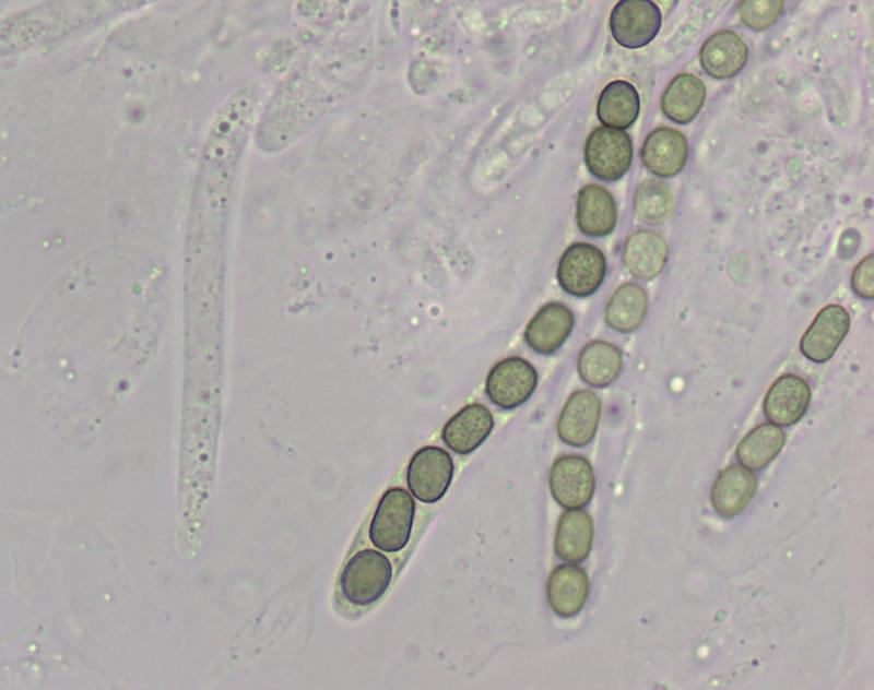 macrostoma