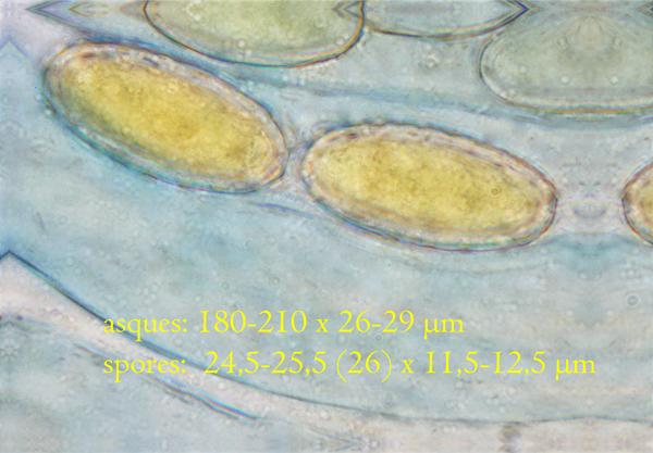 macrostoma