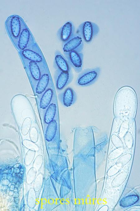 macrostoma