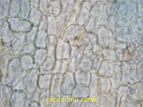 macrostoma