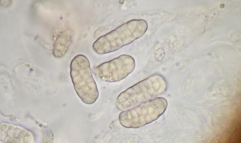 macrostoma