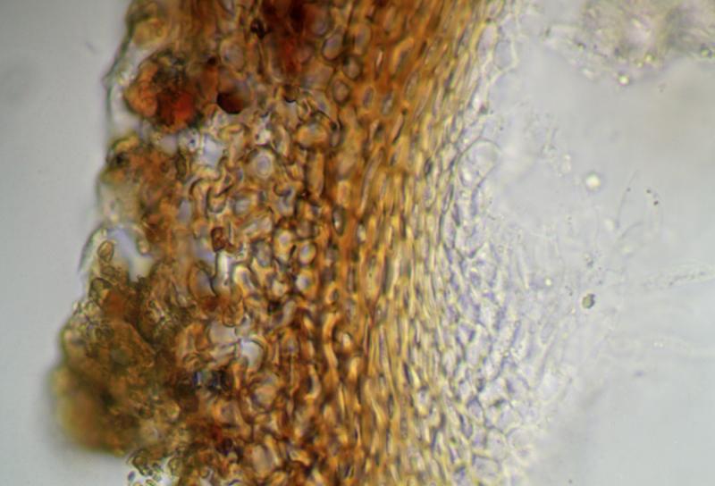 macrostoma