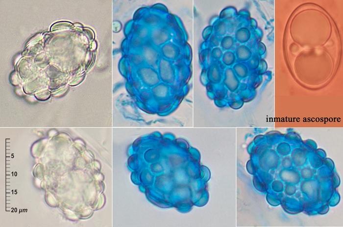 macrostoma
