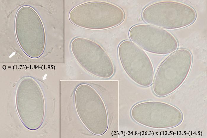 macrostoma